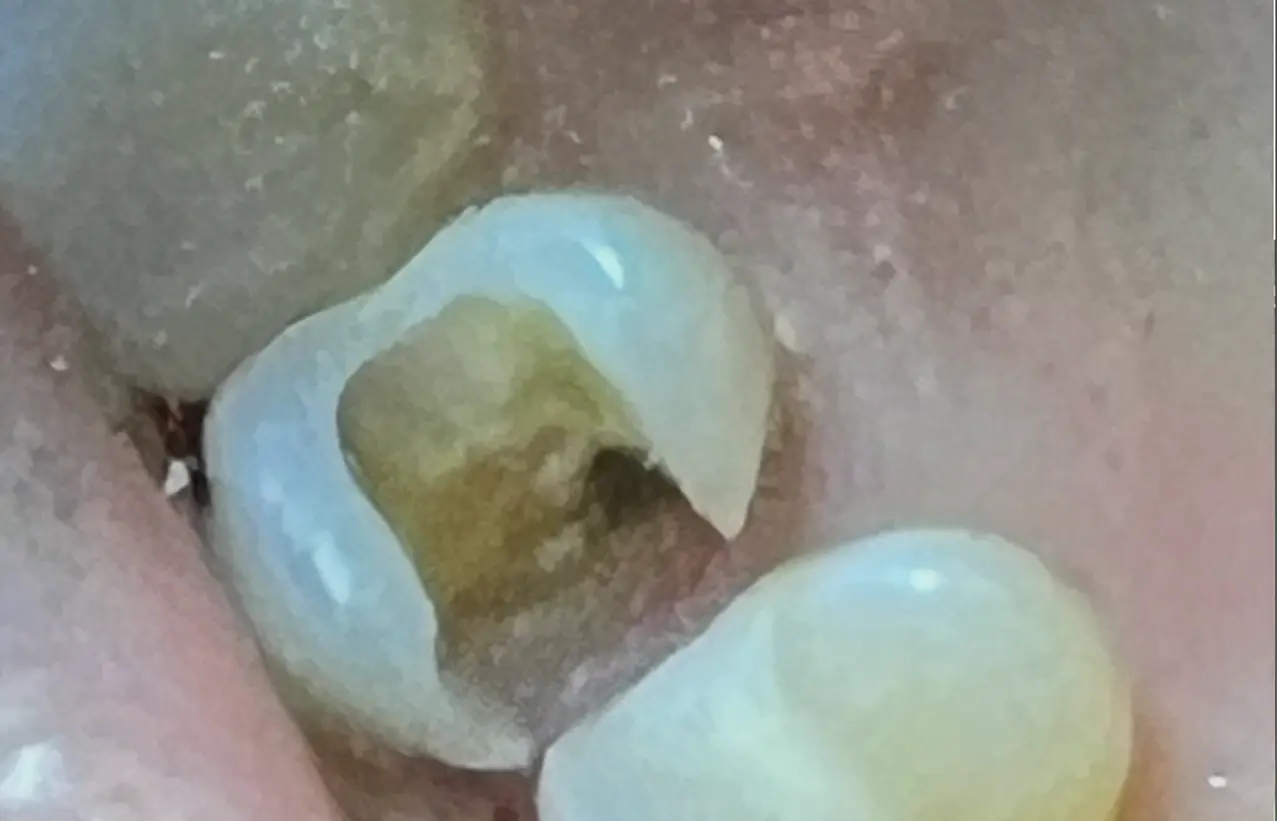 Before treatment