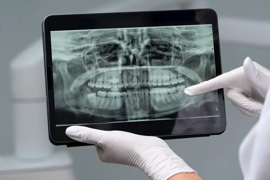 Digital Radiography Rochester Hills