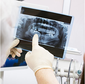 Oral Cancer Screening Rochester Hills Dentist