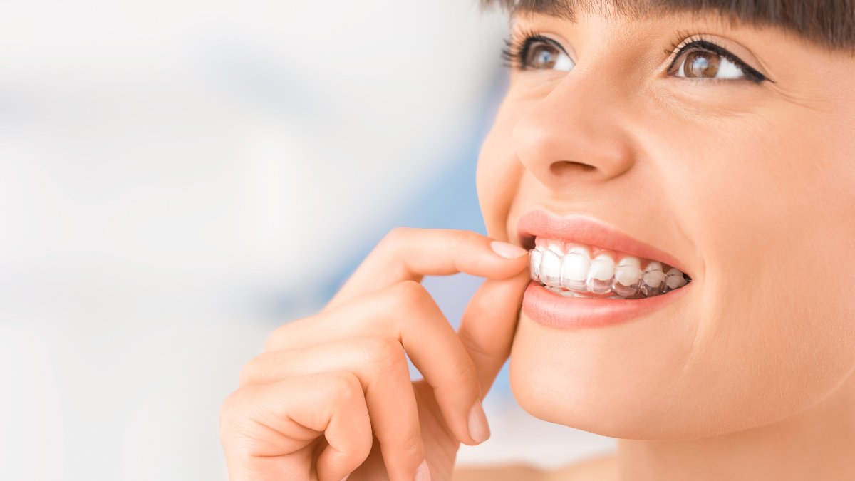Aftercare instructions of invisalign